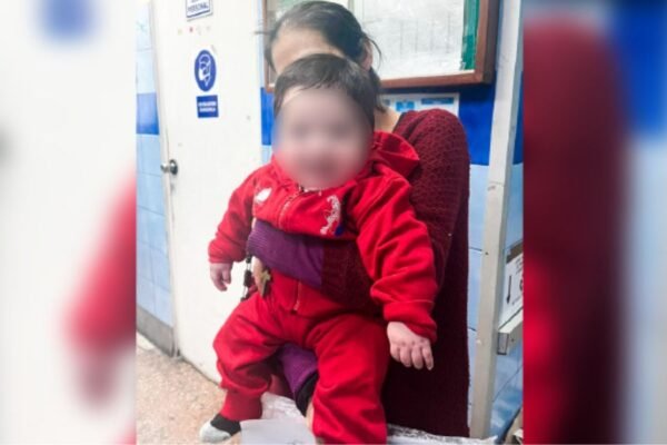 Nuevo hito médico: bebé de cinco meses sobrevive tras perder el 90 % del abdomen gracias a innovador procedimiento en el Hospital Dos de Mayo