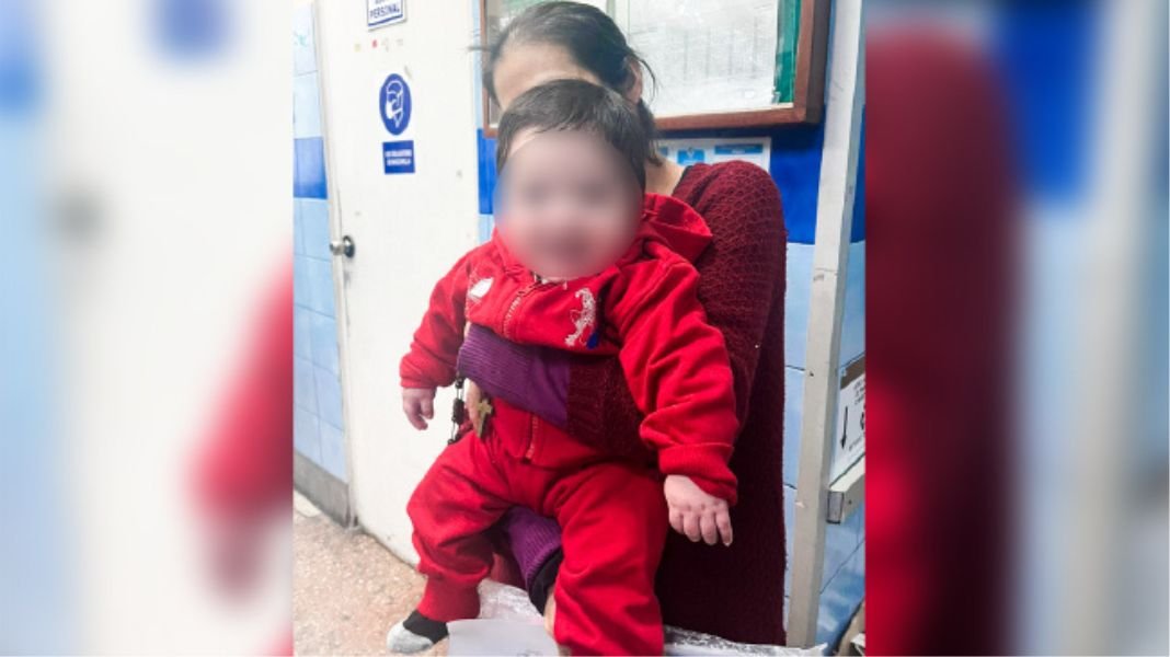 Nuevo hito médico: bebé de cinco meses sobrevive tras perder el 90 % del abdomen gracias a innovador procedimiento en el Hospital Dos de Mayo