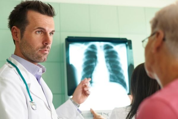 1 de cada 4 casos de cáncer de pulmón ocurre en personas que nunca han fumado