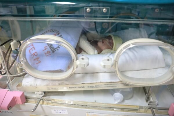 En los hospitales del Minsa, los neonatos prematuros son vigilados de forma permanente y, tras el alta deben pasar por controles periódicos