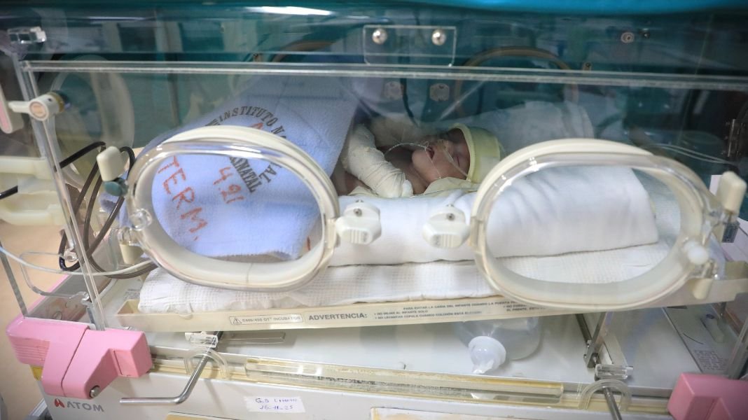 En los hospitales del Minsa, los neonatos prematuros son vigilados de forma permanente y, tras el alta deben pasar por controles periódicos