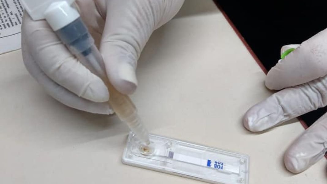 Minsa utiliza prueba FIT para tamizaje de detección oportuna de cáncer de colon y recto