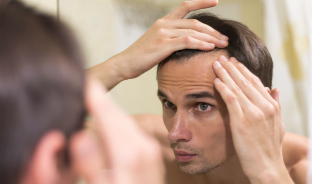 Caída del cabello: cuatro señales tempranas que muchas personas ignoran