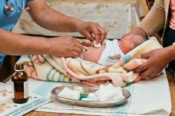 Minsa: Recomendaciones para la correcta limpieza y cuidado del cordón umbilical en recién nacidos