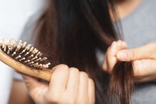 Especialistas advierten que no toda caída de cabello se debe al invierno