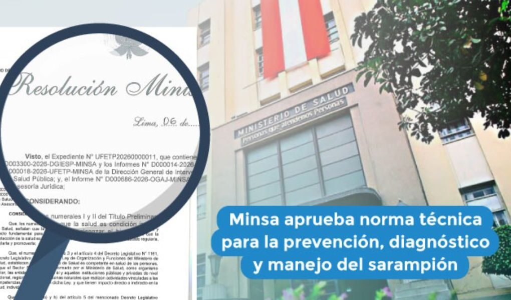 Minsa aprueba norma técnica para la prevención, diagnóstico y manejo del sarampión