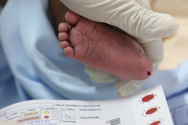 Tamizaje neonatal: una prueba que salva vidas y garantiza el bienestar de los recién nacidos