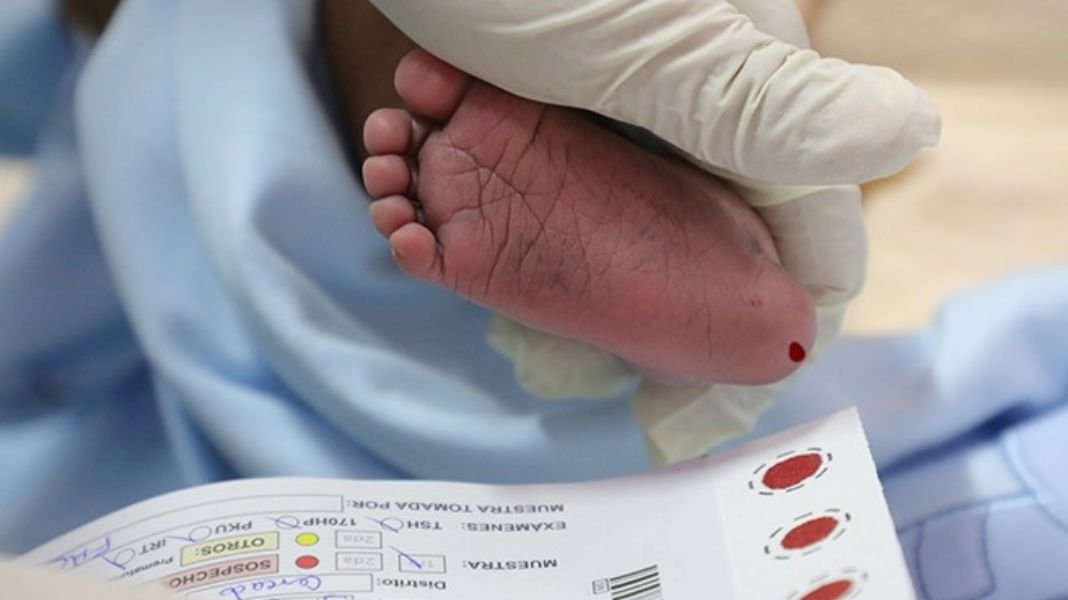 Tamizaje neonatal: una prueba que salva vidas y garantiza el bienestar de los recién nacidos