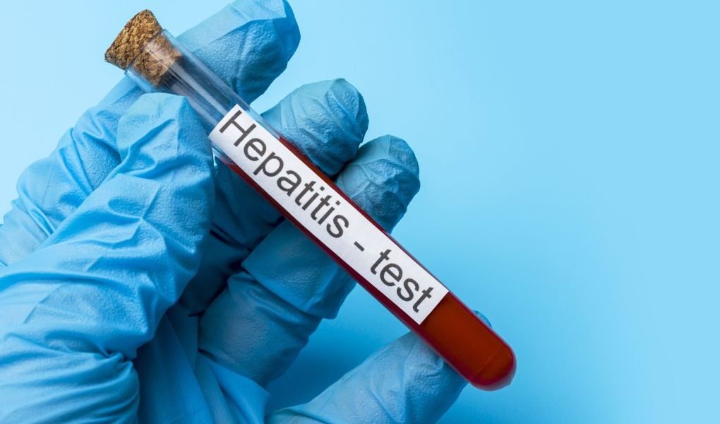 ¿Podrías tener hepatitis sin saberlo? Cuatro mitos que retrasan su detección 