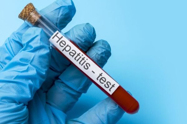 ¿Podrías tener hepatitis sin saberlo? Cuatro mitos que retrasan su detección 