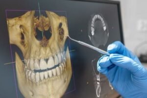 ¿Y si en el futuro pudieras recuperar un diente sin necesidad de implantes?