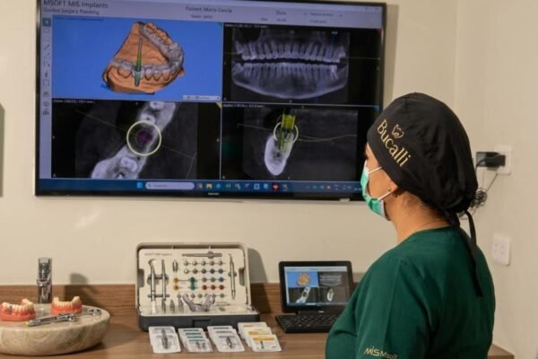 ¿Por qué los implantes dentales NO son para cualquiera? La verdad que pocos te cuentan.
